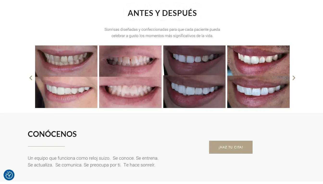 DENTARTIST CLINIC - antes y después 4